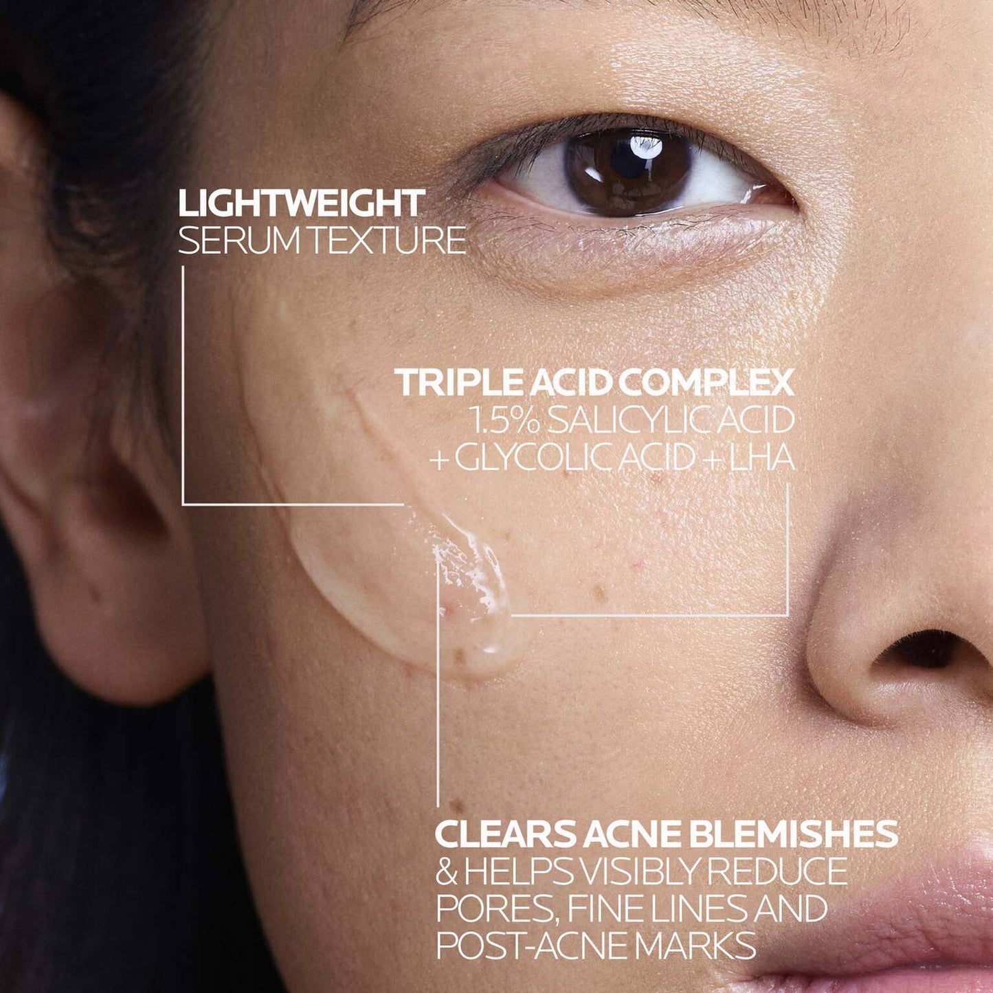effaclar-salicylic-acid-acne-treatment-serum-q0 LaRochePosay-Product-Effaclar-Effaclar-Serum-30ml-3337875722827-Texture-REV.jpg
