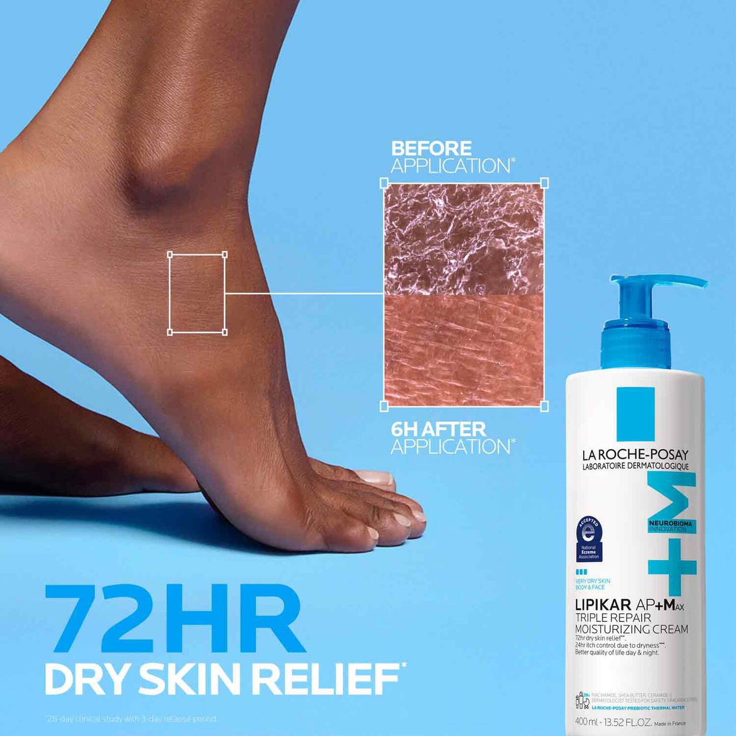 lipikar-ap-max-triple-repair-moisturizing-cream-q4 LaRochePosay-Product-Skincare-Lipikar-Balm-AP+MAX-400ml-3337875941150-ATF-PIM-BeforeAfter.jpg