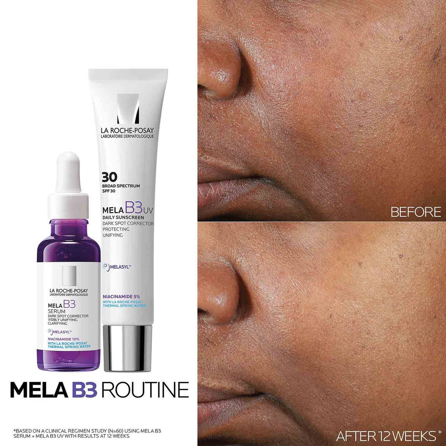 mela-b3-dark-spot-serum-with-melasyltm-niacinamide-d2 Mela-B3-routine_1500X1500.jpg