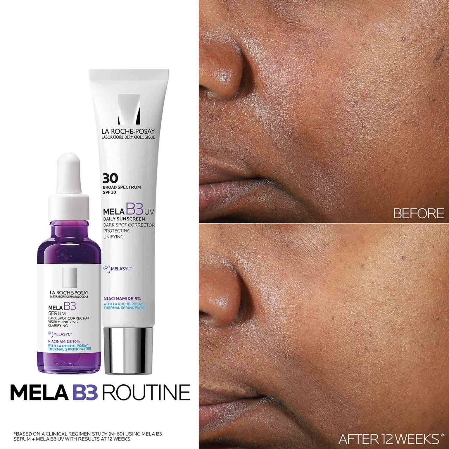 mela-b3-dark-spot-serum-with-melasyltm-niacinamide-d2 Mela-B3-routine_1500X1500.jpg